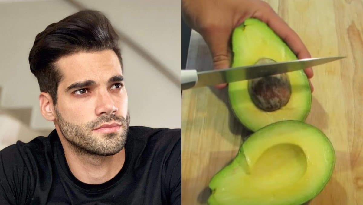 ¿Qué es la mano de aguacate?, el accidente por el que Guty Carrera terminó en el hospital