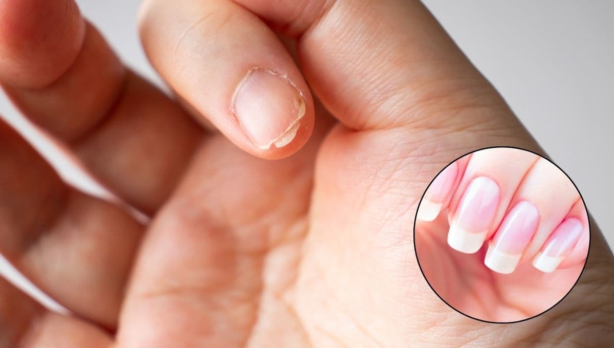 Uñas naturales: 3 remedios caseros para hacerlas crecer rápido