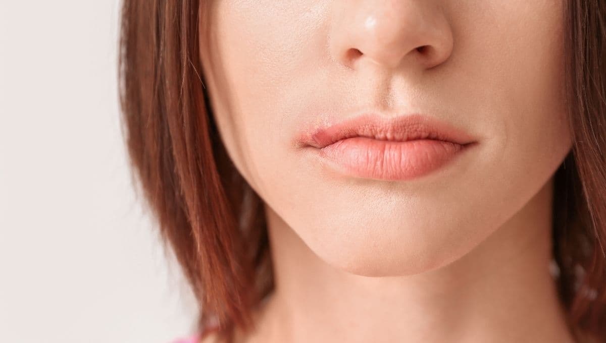 ¿Cómo eliminar un fuego labial?