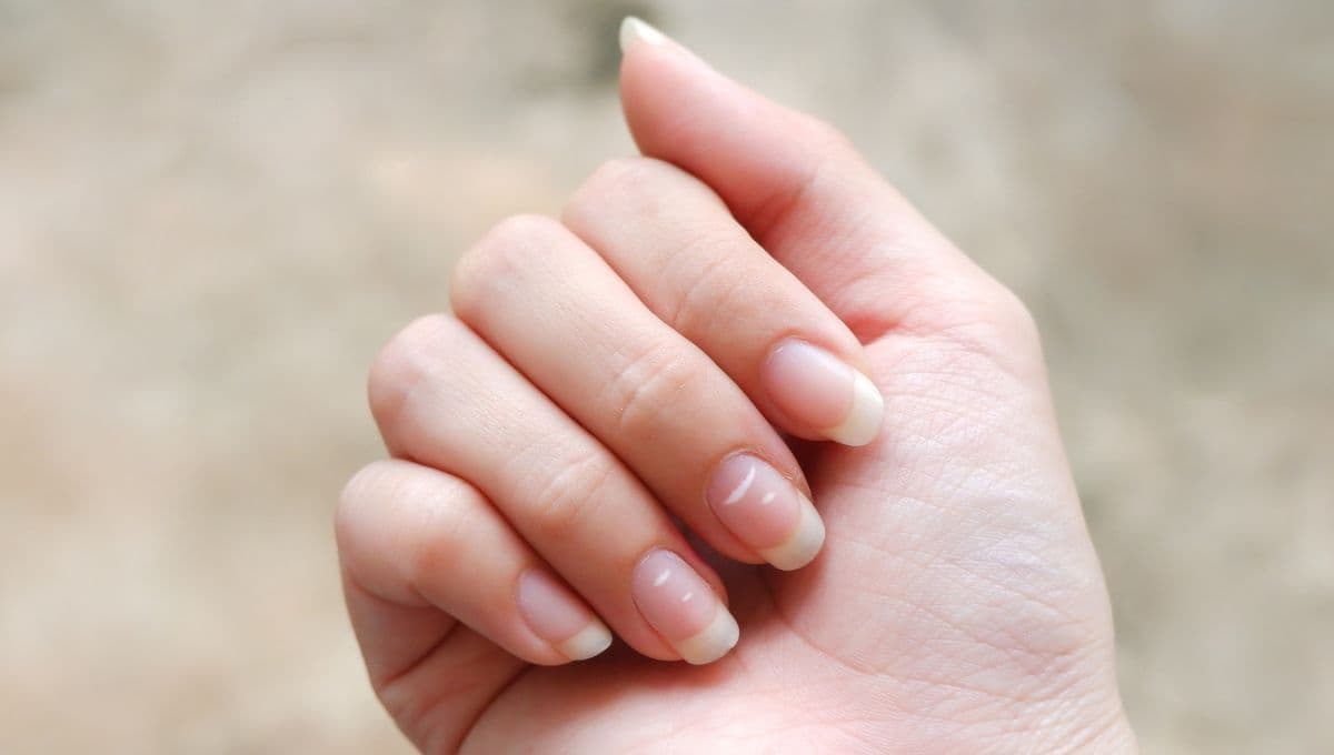 por que me salen manchas en las uñas